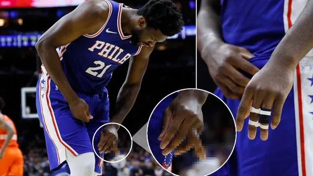 basketball injury finger